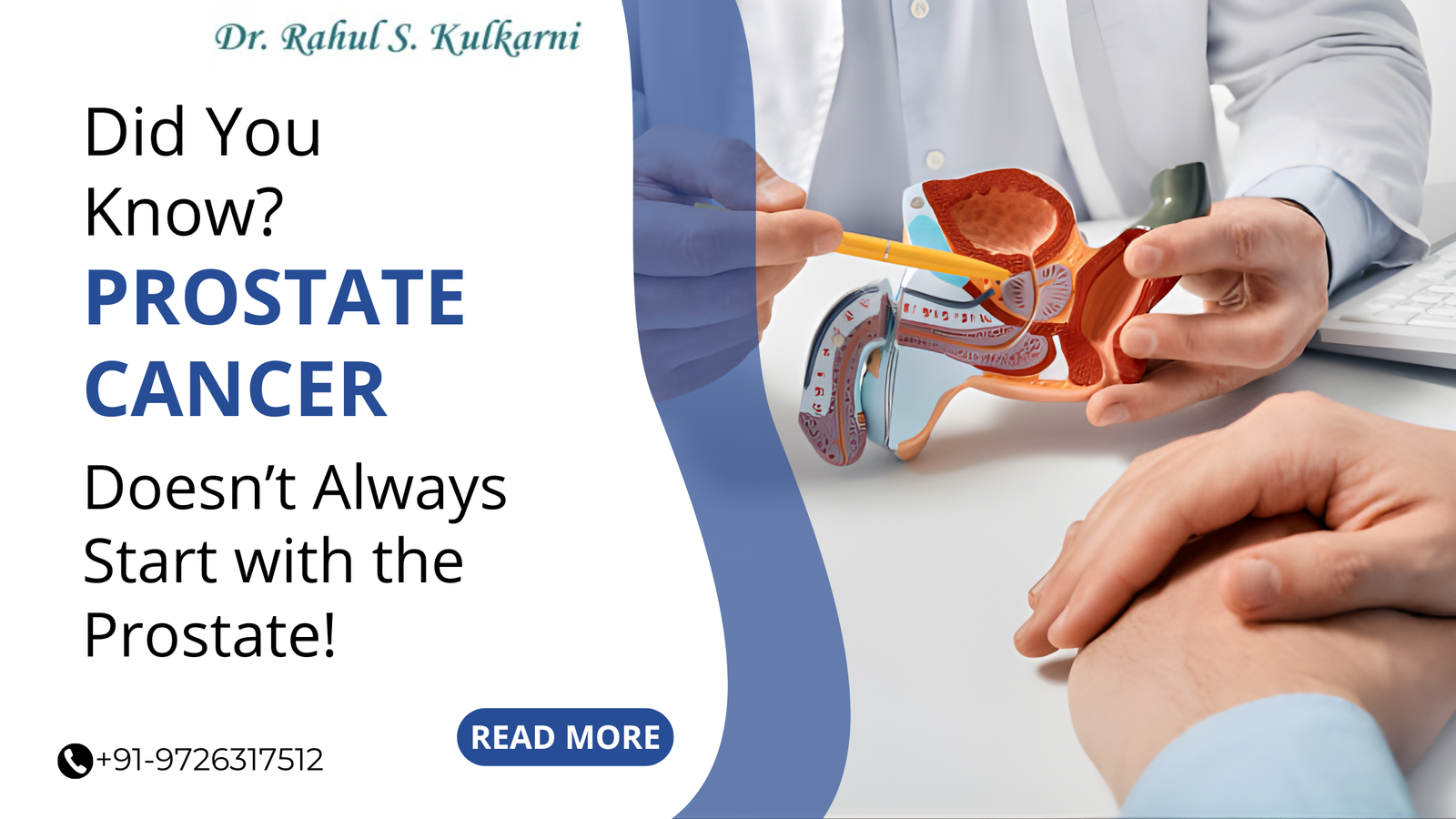 Did You Know? Prostate Cancer Doesn’t Always Start with the Prostate!